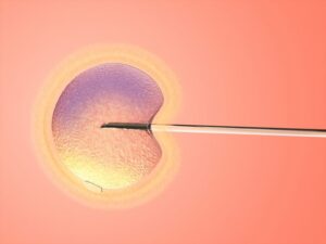 What Causes of Infertility Can IVF Treat?