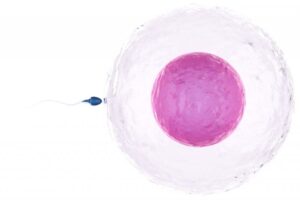 Genetic Diagnosis and Its Impact on IVF