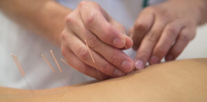 Acupuncture and IVF