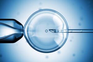 Six Facts Everyone Considering IVF Should Know About PGS